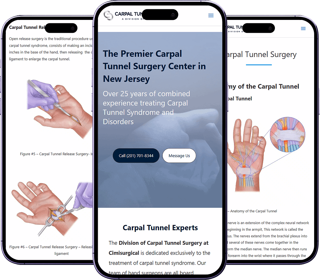 Mobile previews of a procedure-focused carpal tunnel surgery website with treatment information and medical illustrations.