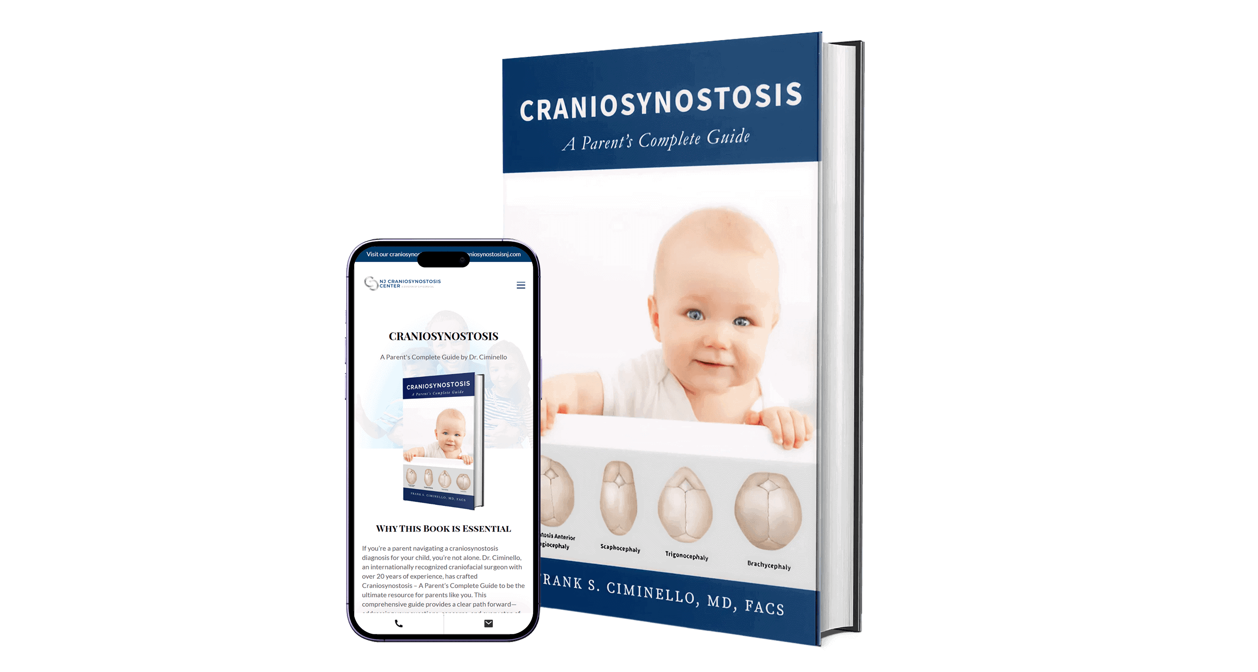 Craniosynostosis book displayed in print and mobile formats to illustrate multi-format healthcare publishing.