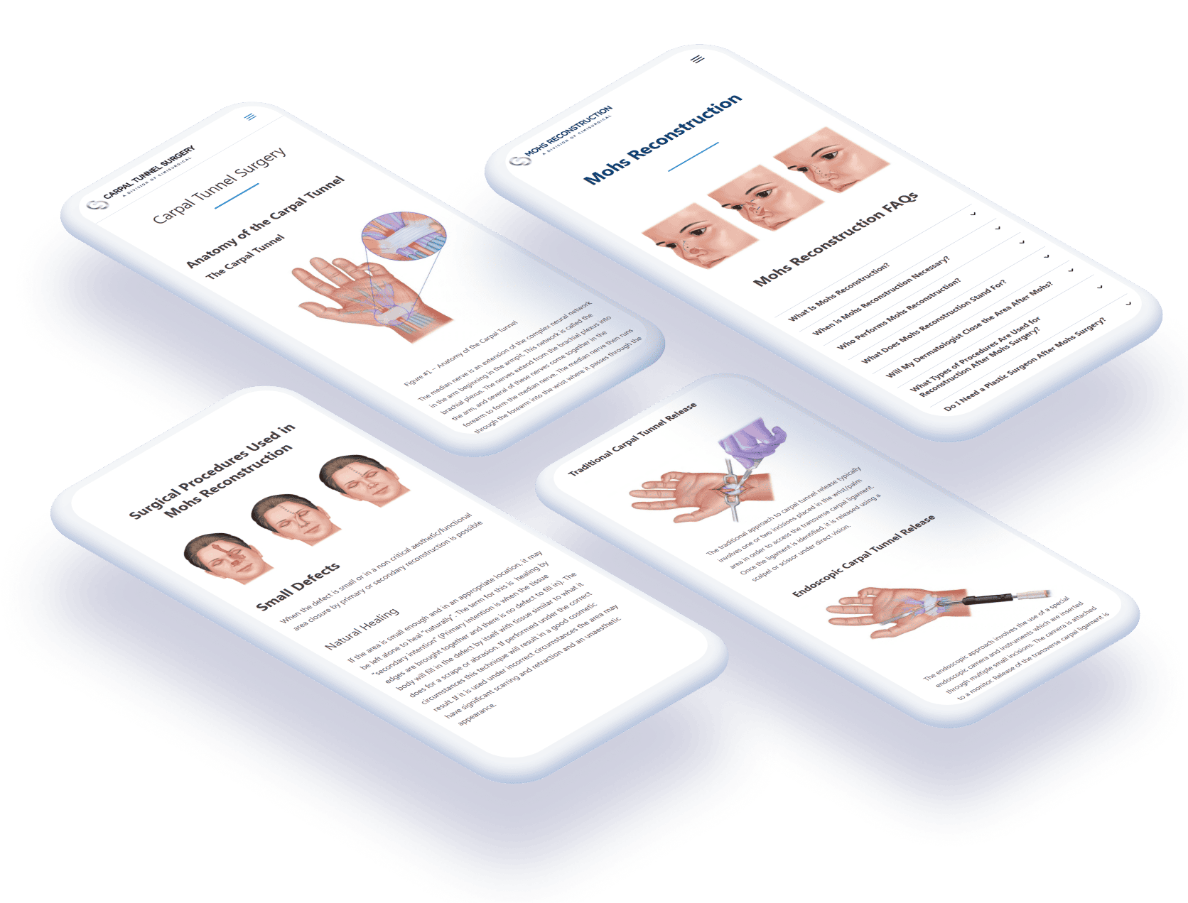 Four mobile healthcare education page mockups featuring custom hand anatomy, surgical, and facial procedure illustrations.