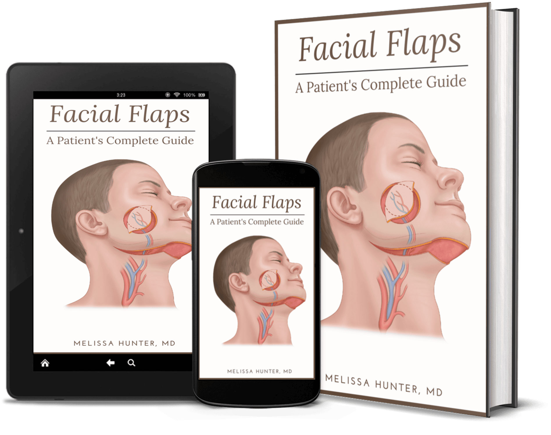 Facial Flaps book cover displayed as hardcover, tablet, and smartphone editions to illustrate multi-format publishing.