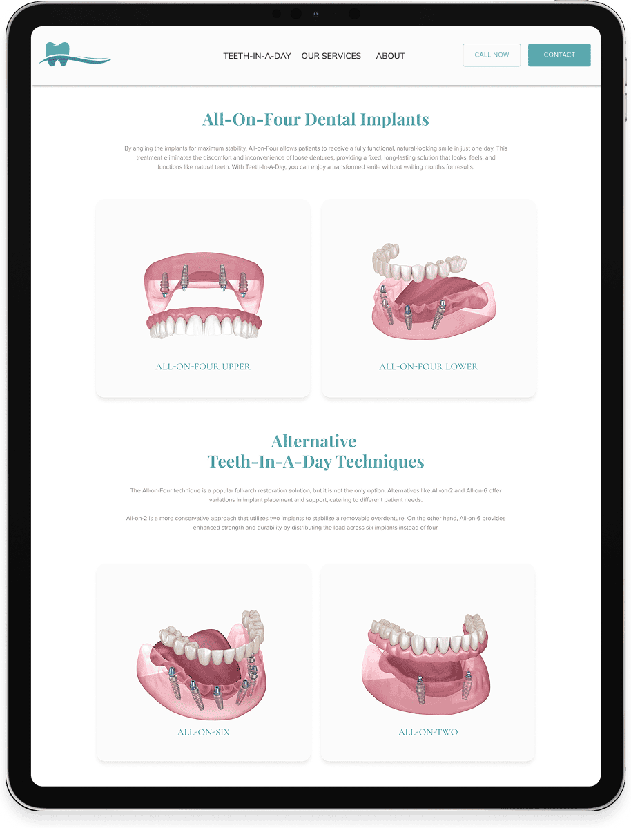 Dental implant series comparing All-on-Four upper and lower arches with alternative implant-supported restoration techniques.