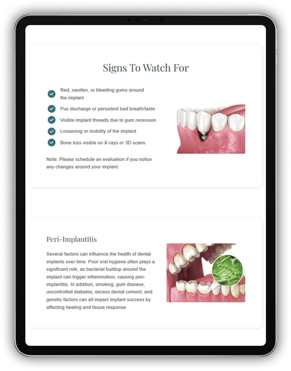 Tablet displaying original patient education content about dental implant warning signs and peri-implantitis.